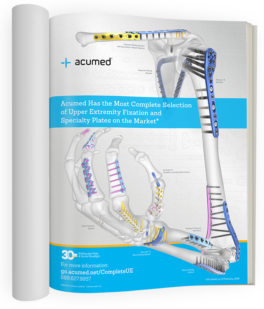 Acumed Has the Most Complete Selection of Upper Extremity Fixation and Specialty Plates on the Market