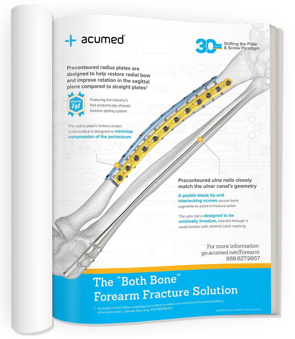 The “Both Bone” Forearm Fracture Solution